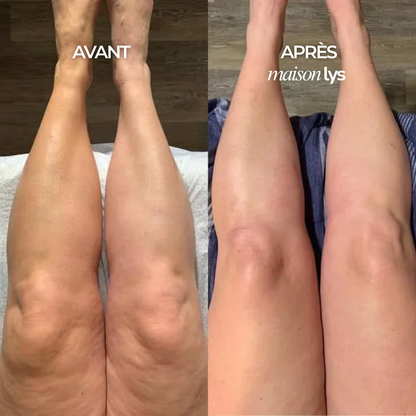 Gouttes Bien-Être Drainage Lymphatique